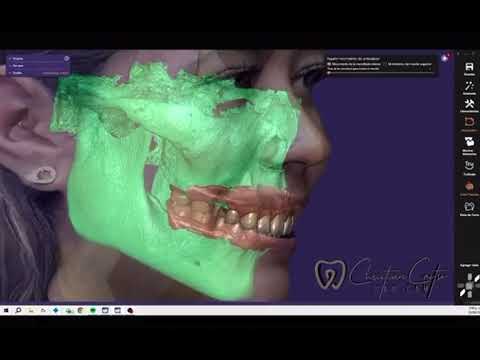 BEWATER DENTALTIX FICC