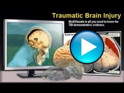 BRAIN VC FCRE